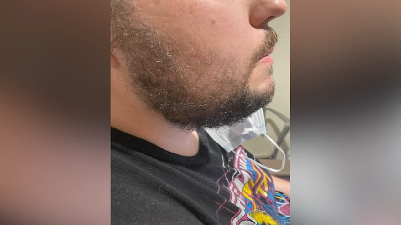 Armed robbery victim needs emergency surgery, incident connected to at least 1 other