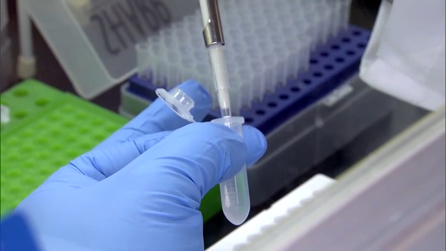 Polio case confirmed in NY, 1st in U.S. since 2013