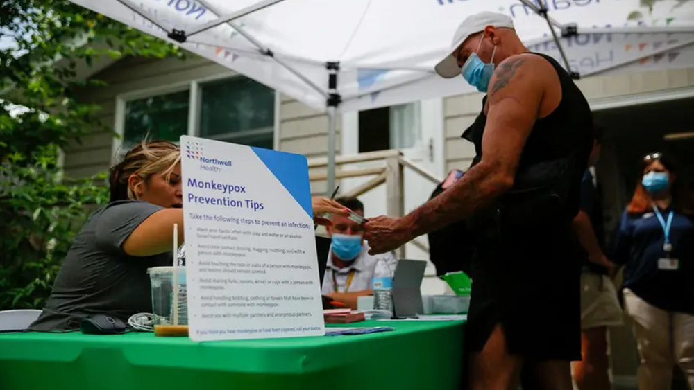 What to know after monkeypox case confirmed in US