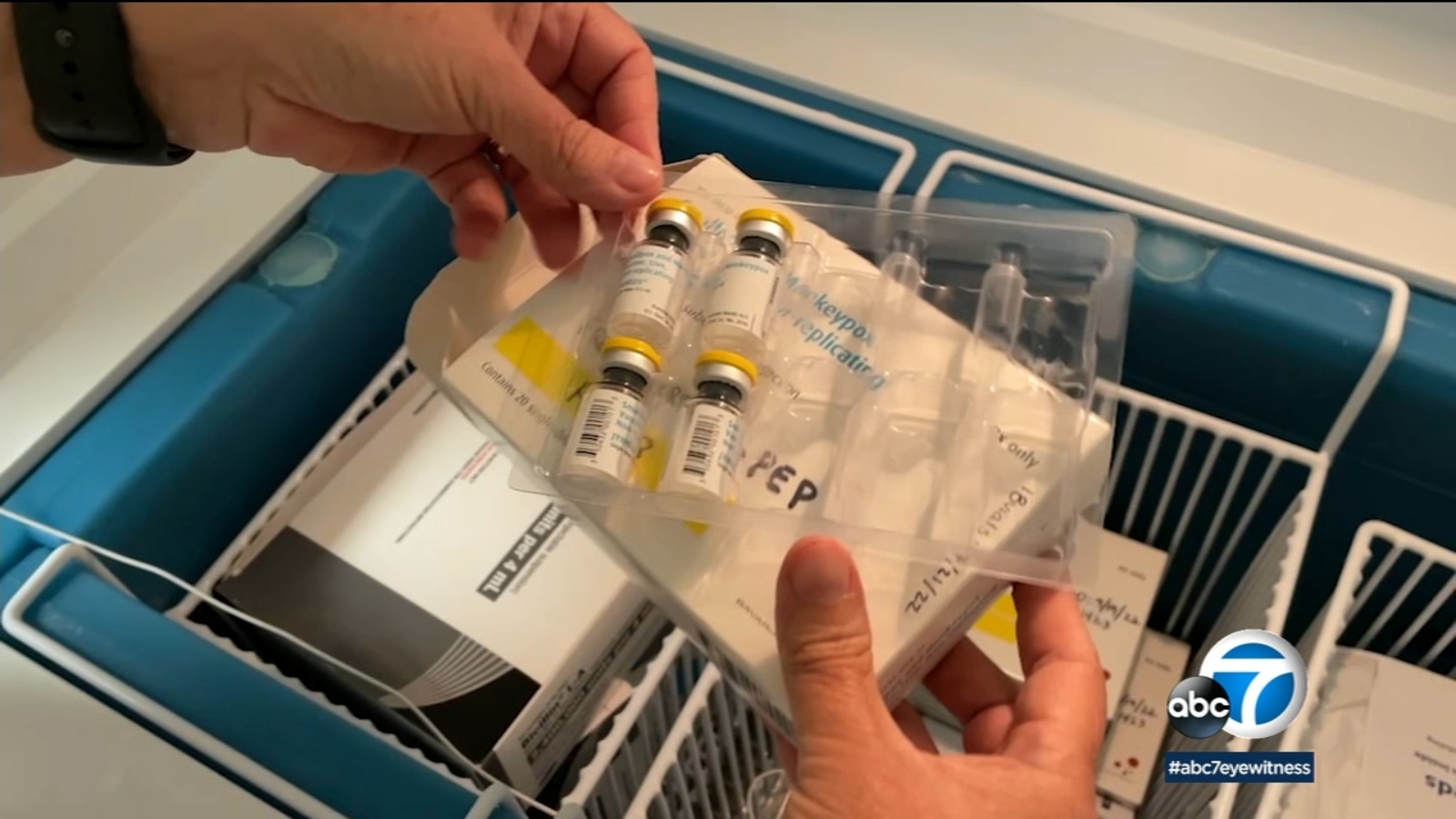 162 cases Monkeypox cases in Los Angeles County, 10 in Long Beach