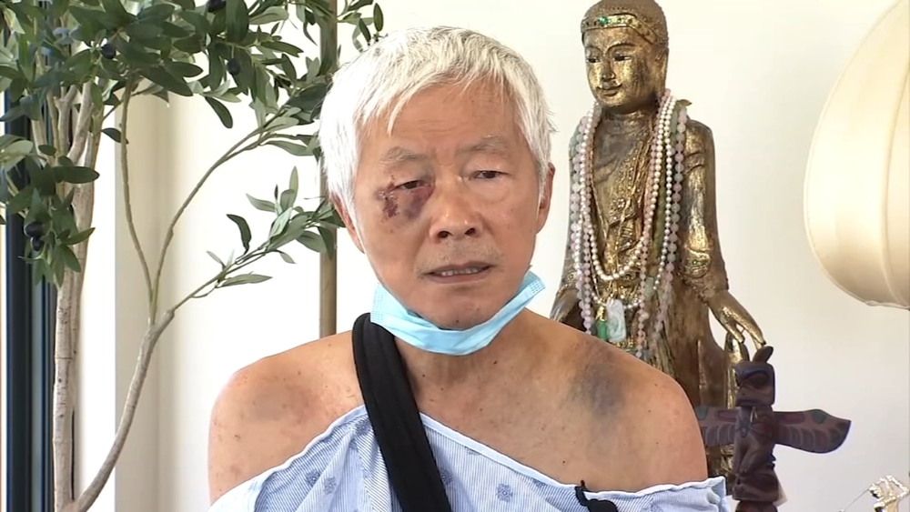 EXCLUSIVE: Images show suspect caught in attack of SF man in his 70s