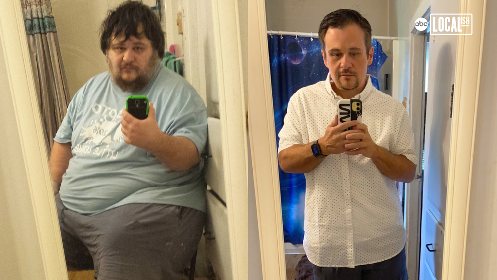 Man inspires others with dramatic weight loss