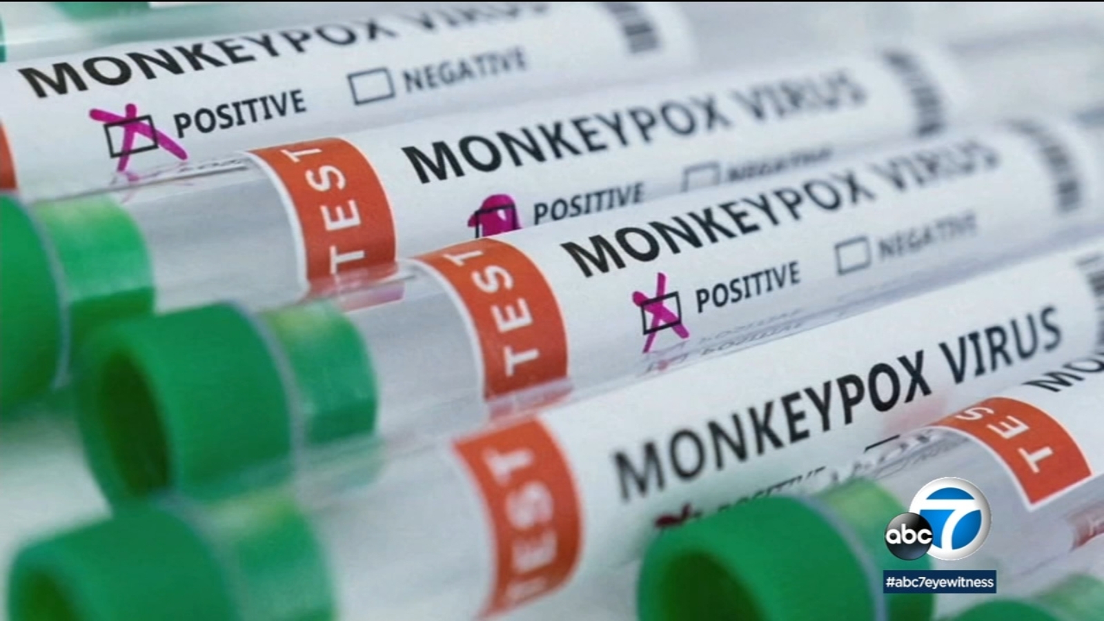 UC campuses alerting students to potential risk, spread of monkeypox as