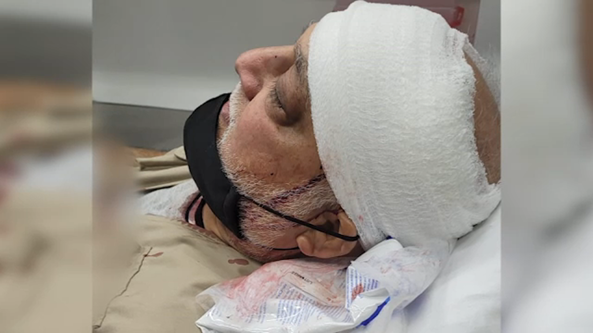 Man brutally attacked on subway while coming home from work