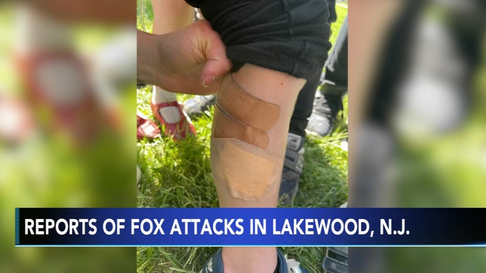 NJ police investigating after multiple children bitten by fox