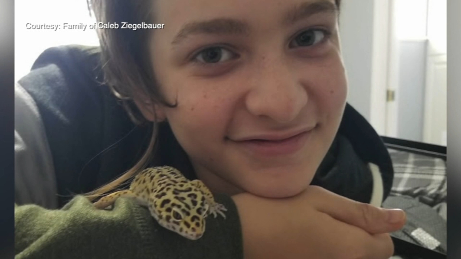 Florida brain eating amoeba Teen Caleb Ziegelbauer being treated at