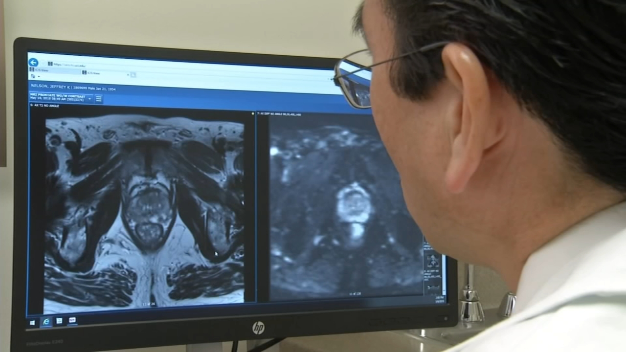 For Prostate Cancer Awareness Month, doctors urge men to get screened