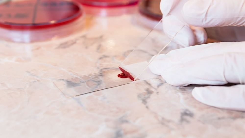 Local non-profit working to educate people during Sickle Cell Awareness Month