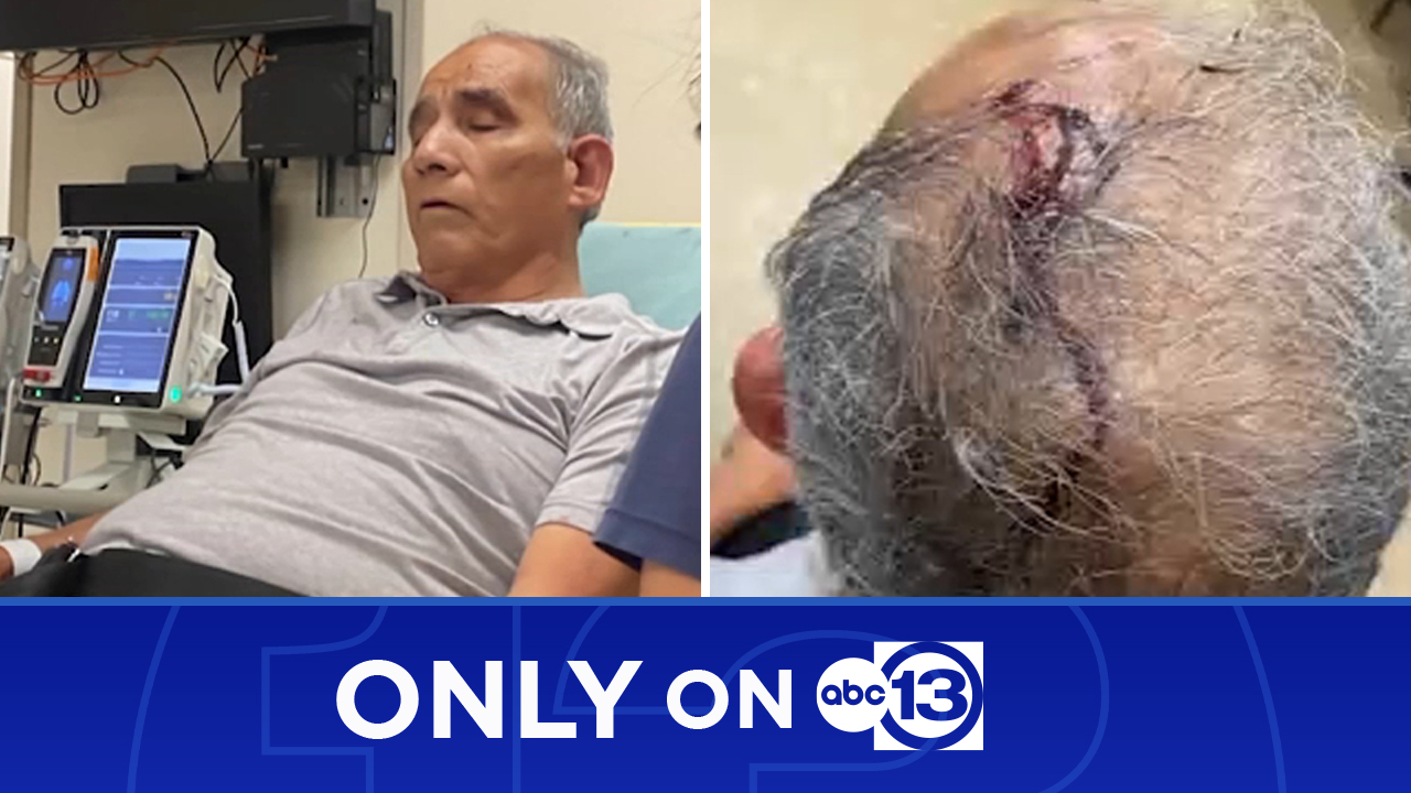 80-year-old man battling cancer bloodied in struggle with robber