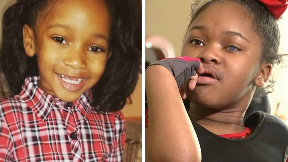 Family awarded $95M after child gets brain damage at dentist
