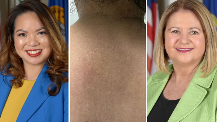 Daly city News ABC7 San Francisco