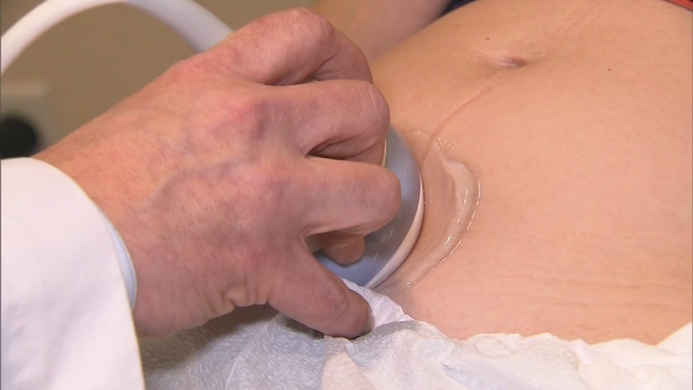 Q&A: Breast cancer and anti-depressants during pregnancy