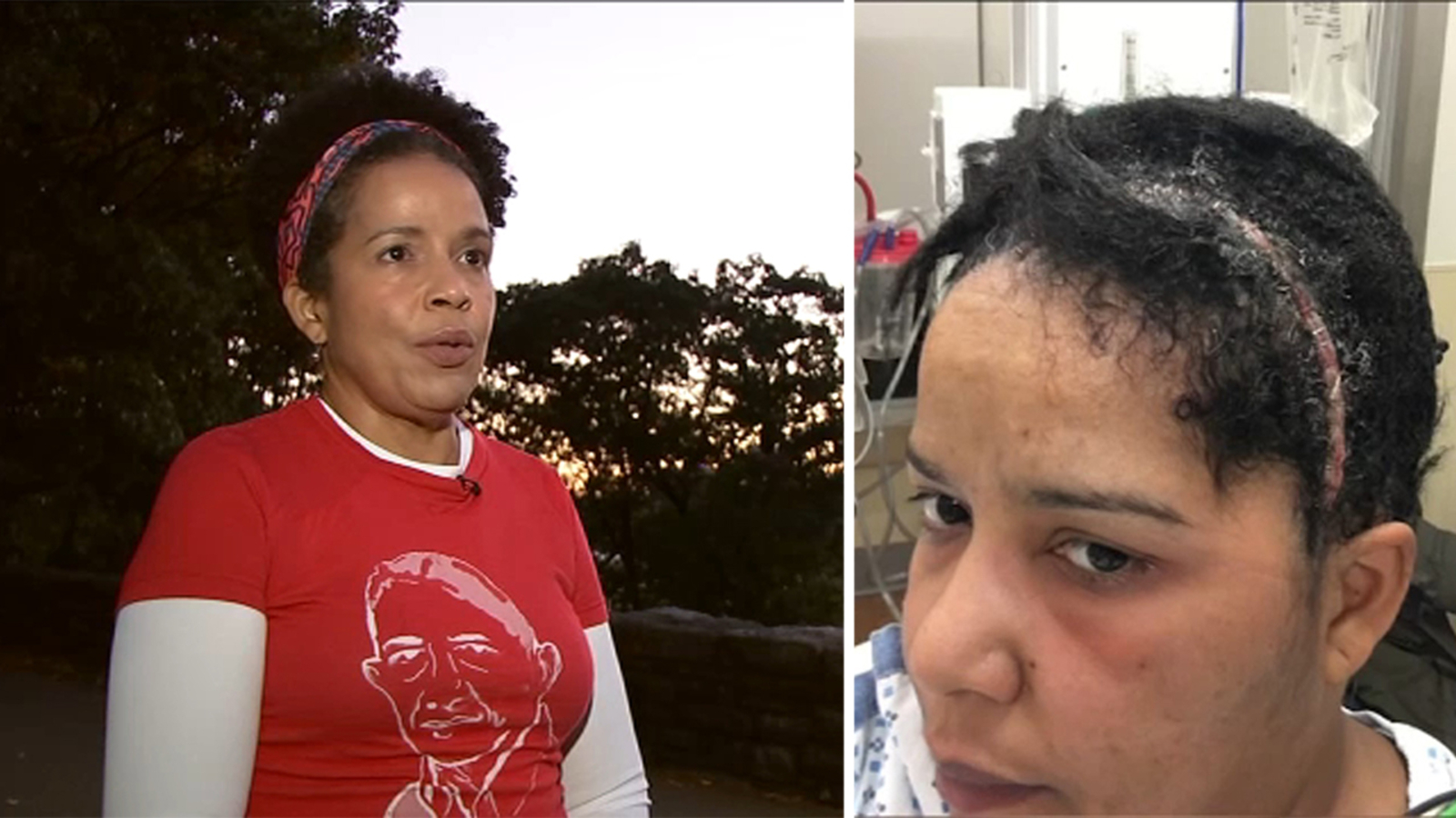 Head Imploded Woman sets sights on TCS New York City Marathon after overcoming life ...