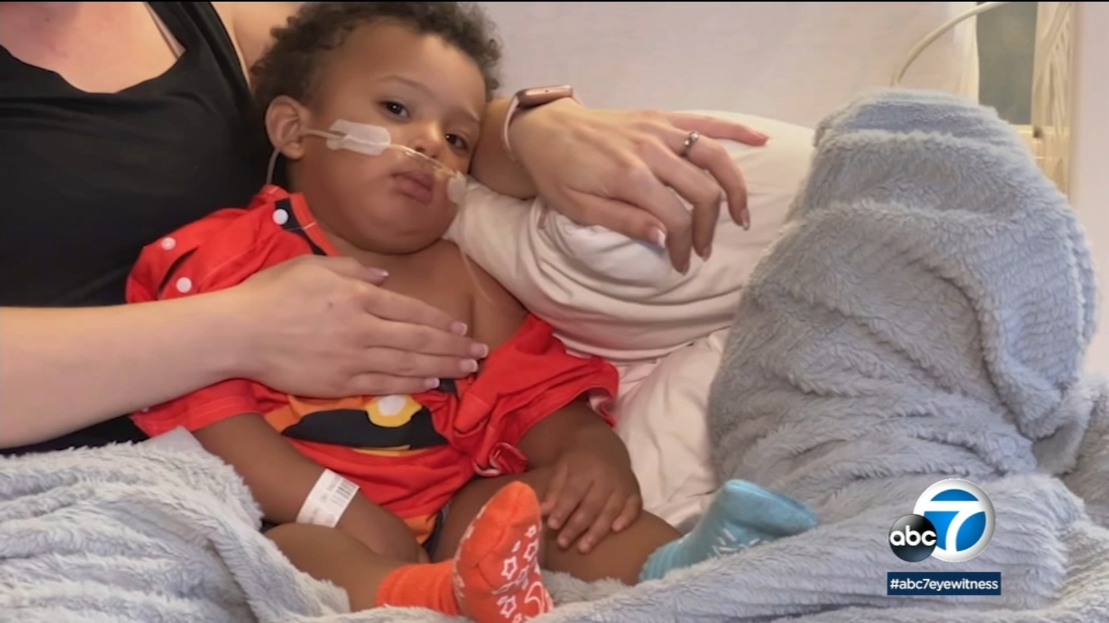 RSV symptoms in kids Doctors share how to spot breathing difficulties