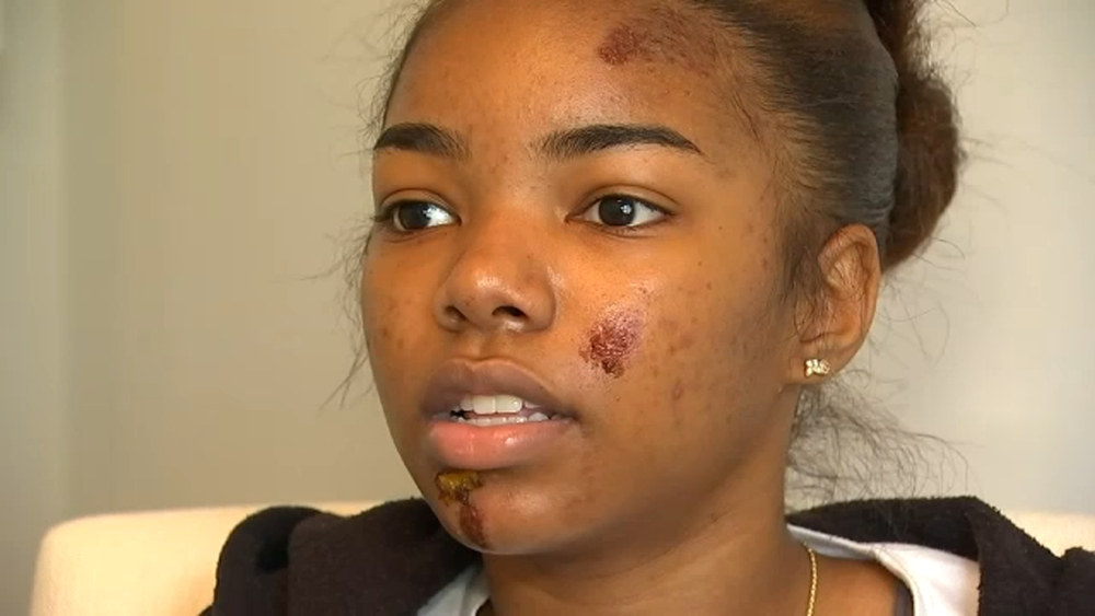 Raleigh teen who jumped from moving car describes terrifying Lyft ride