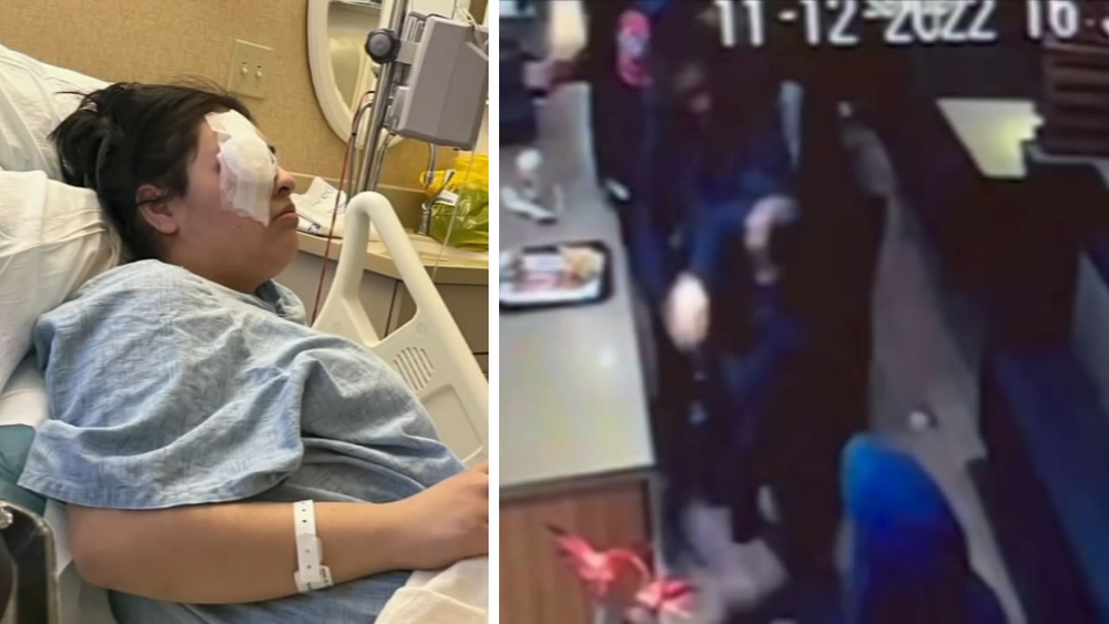 Antioch fast food manager to lose an eye after assault