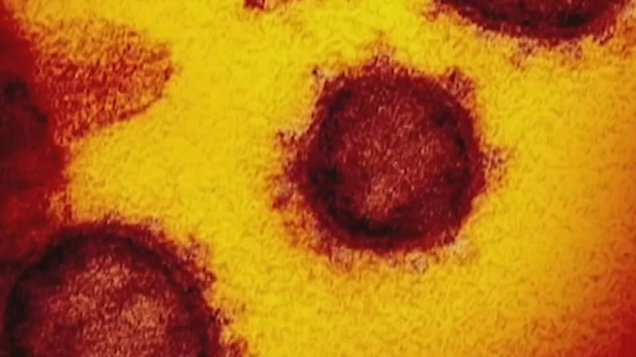 Latest COVID variant causing infections, hospitalizations to spike