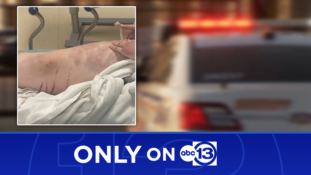 Beaten woman forced to wait hours for deputies, dad says