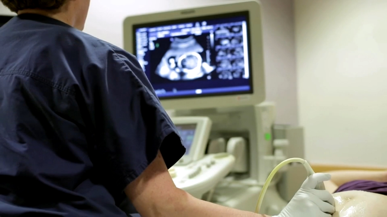 Doctors call for heart health monitoring for postpartum wealth