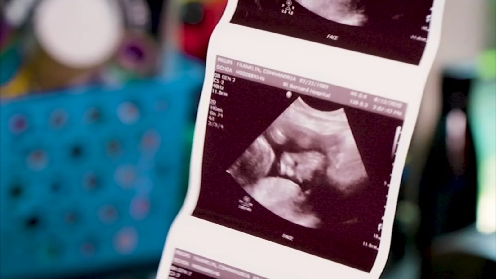 Fresno County raises awareness of doula support for pregnant women - Vimarsana News