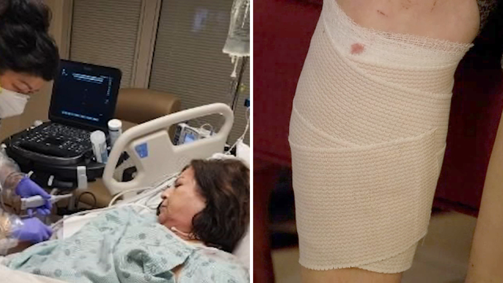 Spring, Texas dog attack: Pre-K teacher Irene Cornish ruptures artery when neighbor's canine mauls her - Vimarsana News