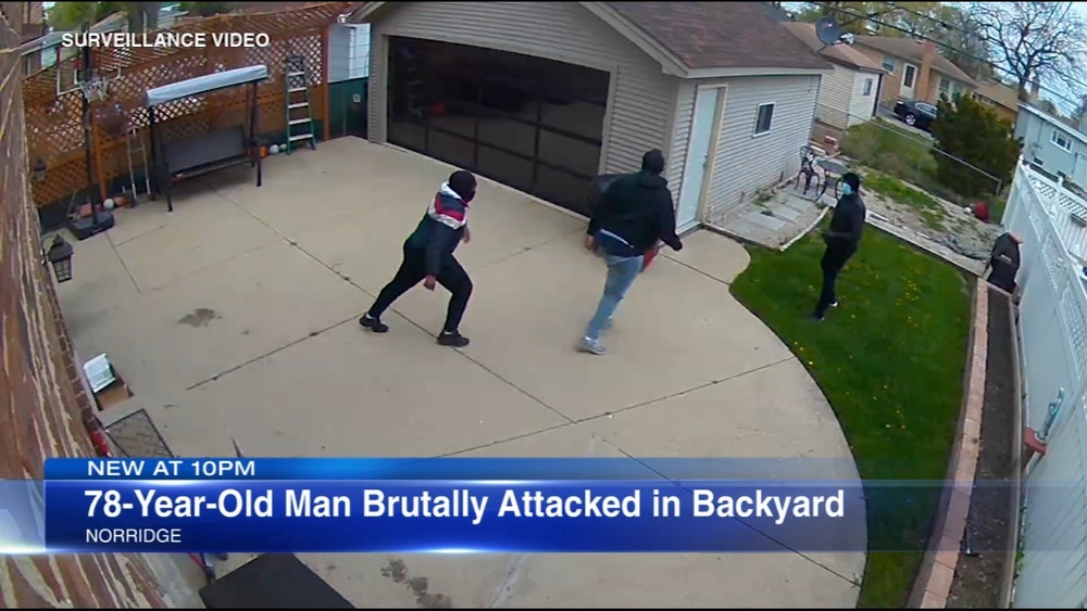 Norridge police investigating attack that critically injured 78-year-old man