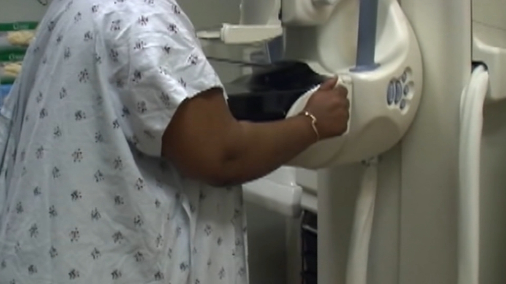Higher breast cancer risk in Blacks shows need for earlier screening