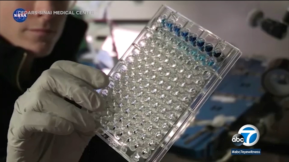 Potentially life-saving solution involving stem cells, outer space