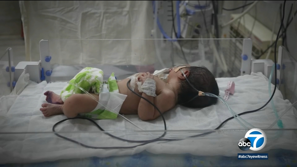 CA maternal mortality rate disproportionately impacts Black women