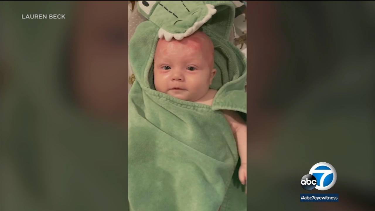 Toddler with rare genetic disorder inspires resiliency, research, hope