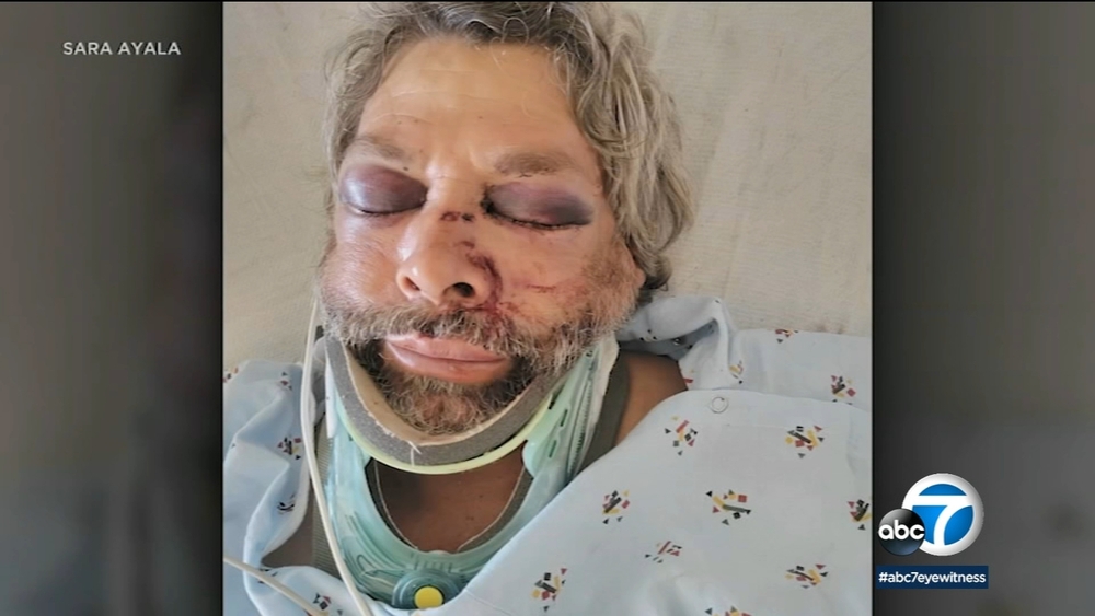 Worker paving OC parking lot viciously attacked on the job: Daughter