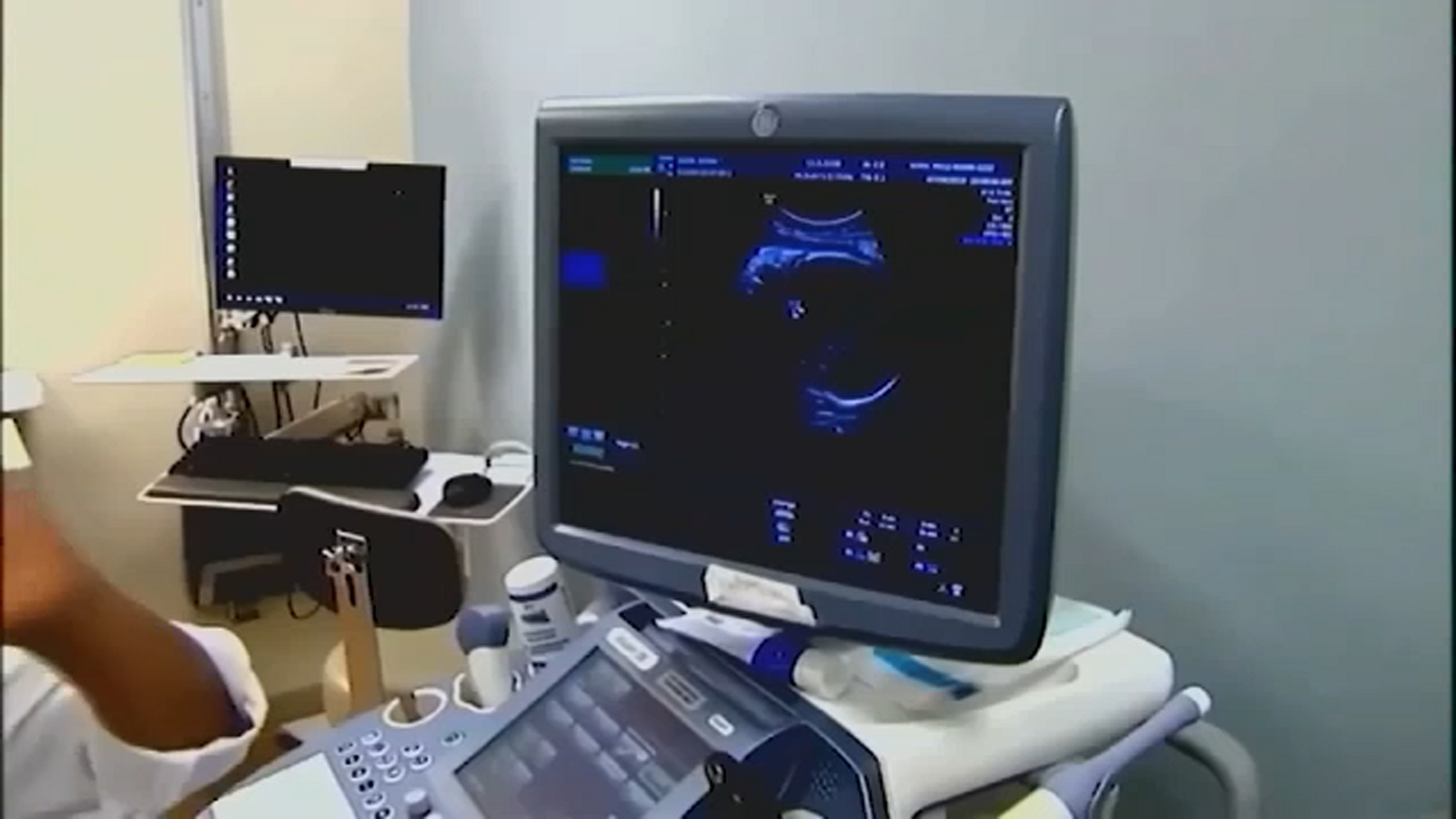 Putting up barriers Raleigh woman reflects on her abortion experience as a teenager