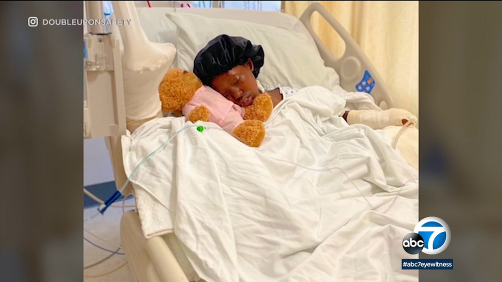 Local teen who lost hand in fireworks accident warns of dangers