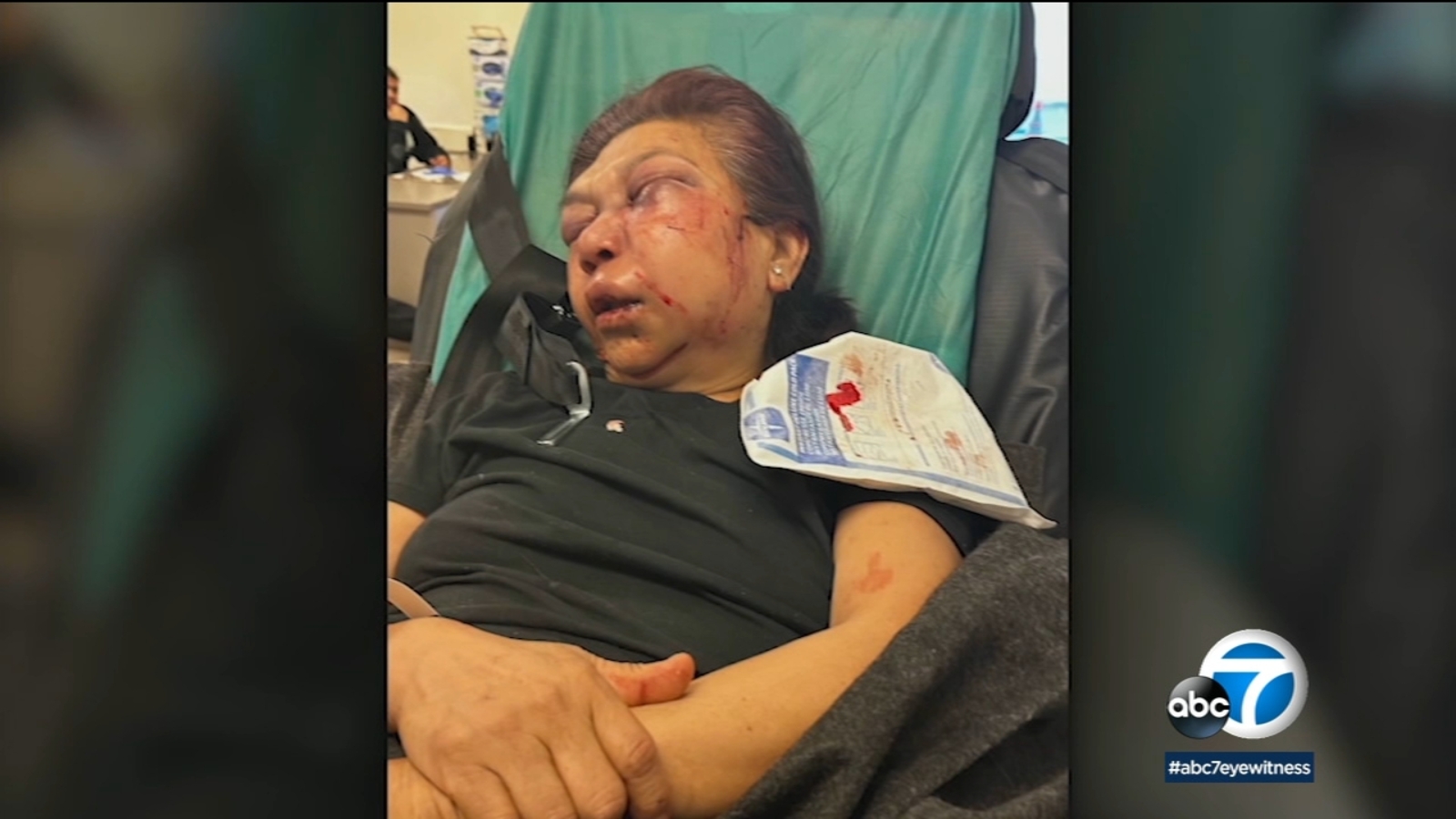 Elderly East Los Angeles woman recovering from brutal, random attack just outside her home - Vimarsana News