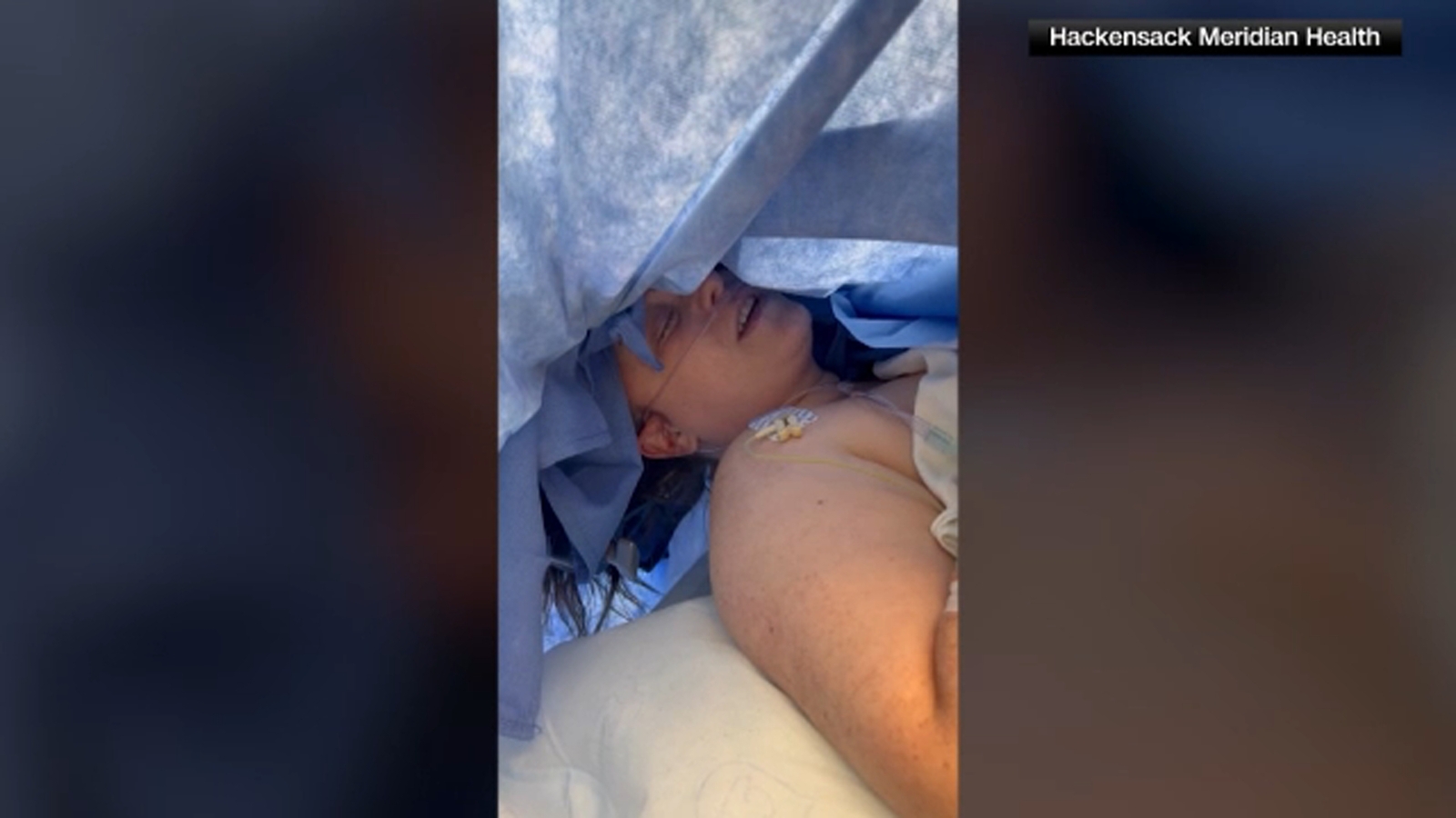 Music on the brain NJ woman sings as doctors perform tumor removal