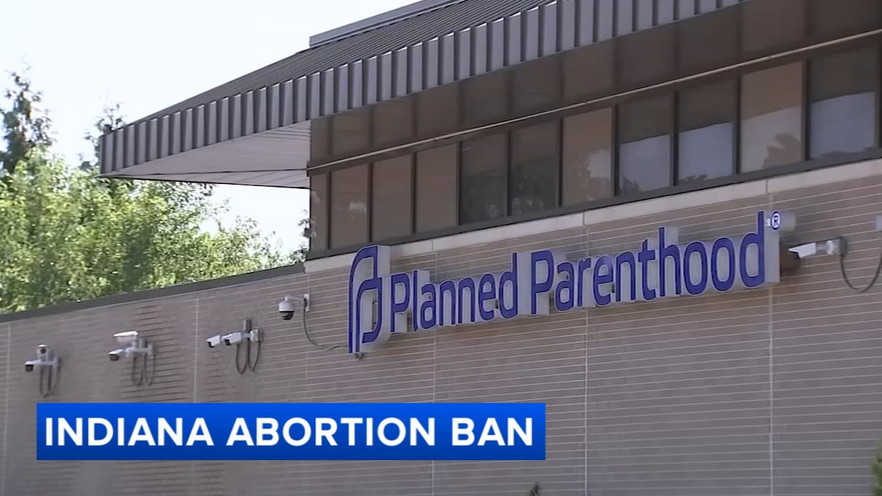 ACLU challenges puts Indiana's near-total abortion ban on hold for now