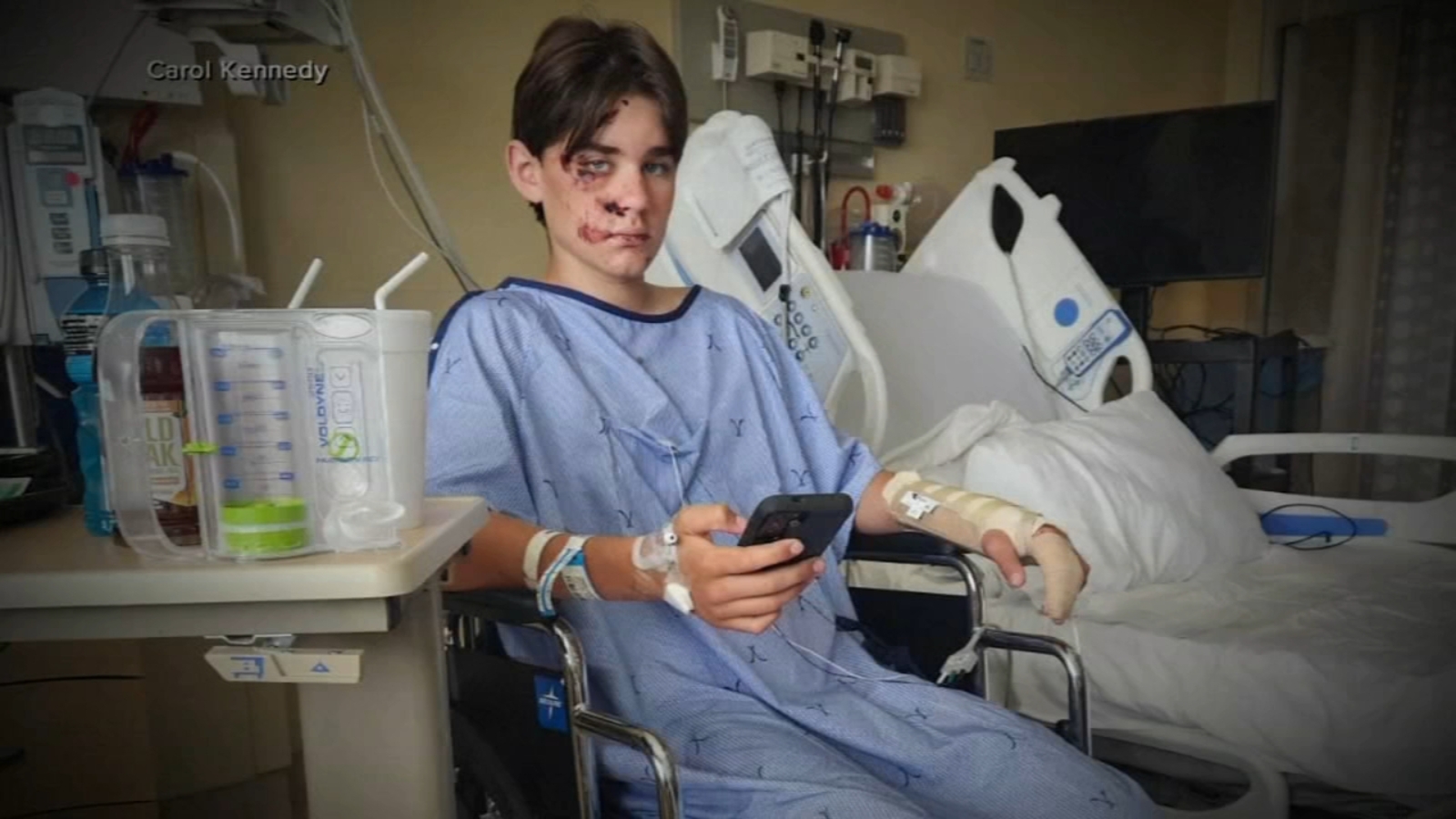 North Dakota teen Wyatt Kauffman survives nearly 100-foot fall at North Rim of Grand Canyon - Vimarsana News