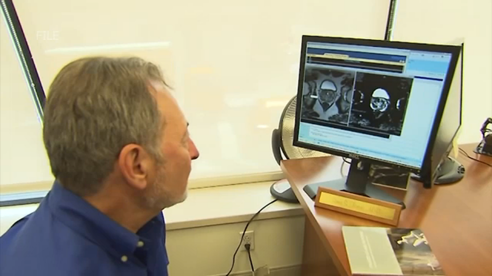 Central California men raise awareness about prostate cancer - Vimarsana News