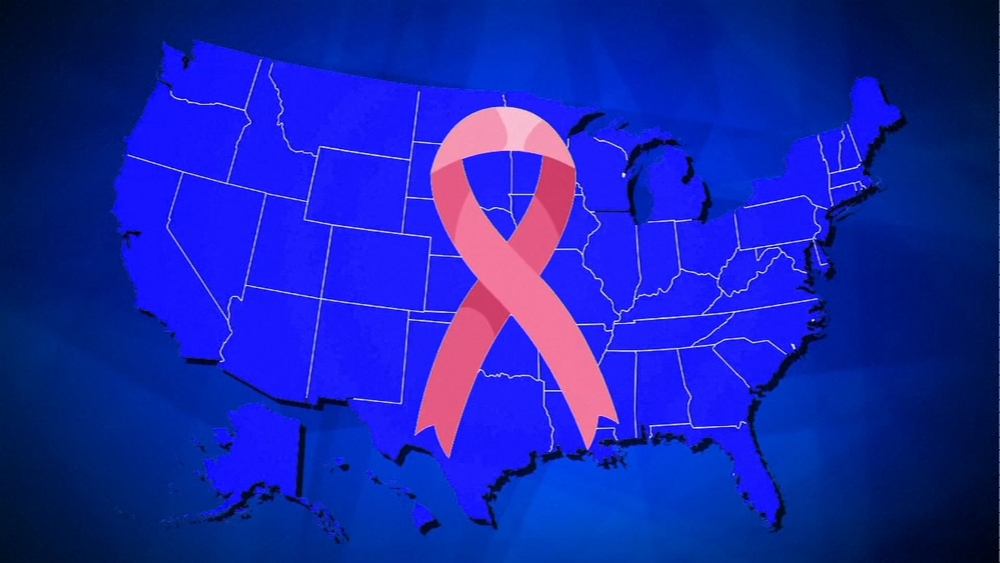 Breast cancer disparities across the US revealed in new JAMA report