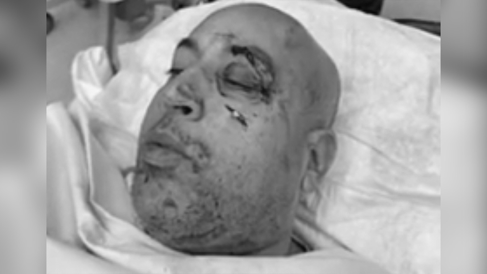 Footage reveals NYPD lieutenant attacked on subway