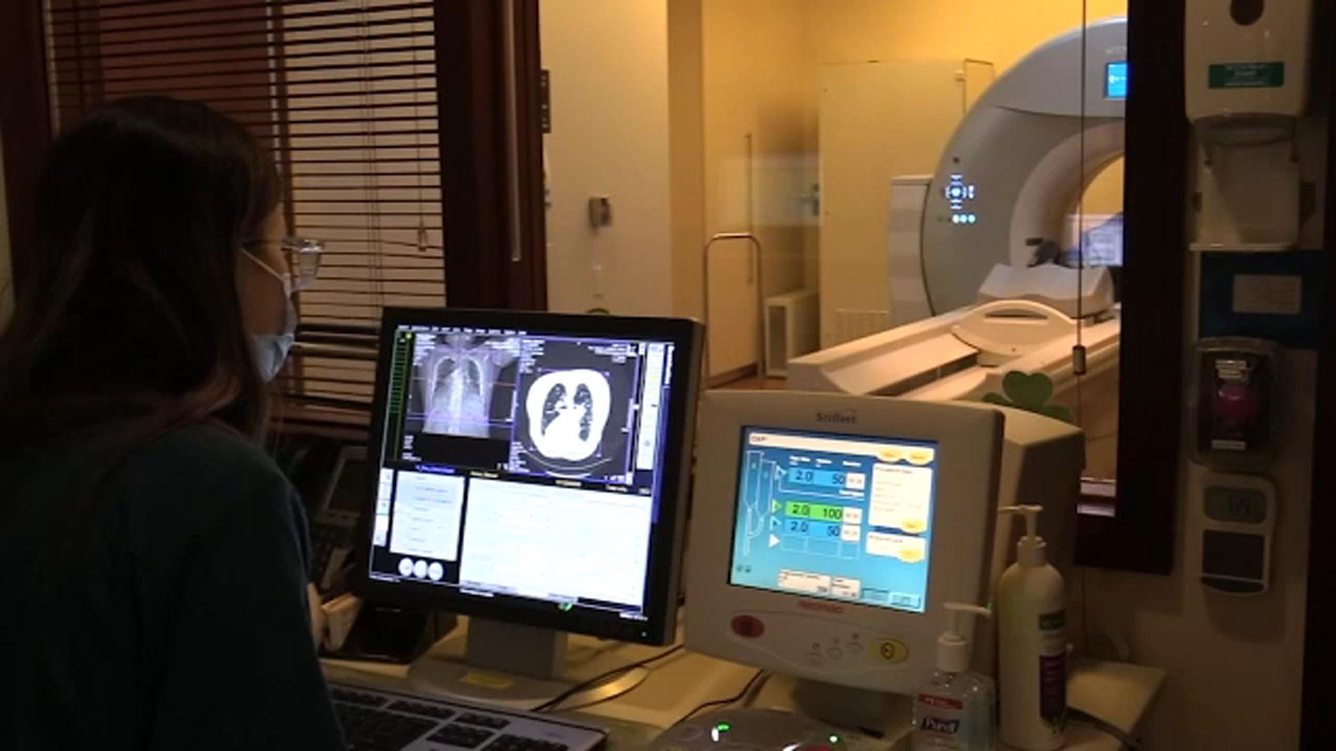 ¿Quién sufre COVID prolongado y por qué? Nuevo estudio revela quienes