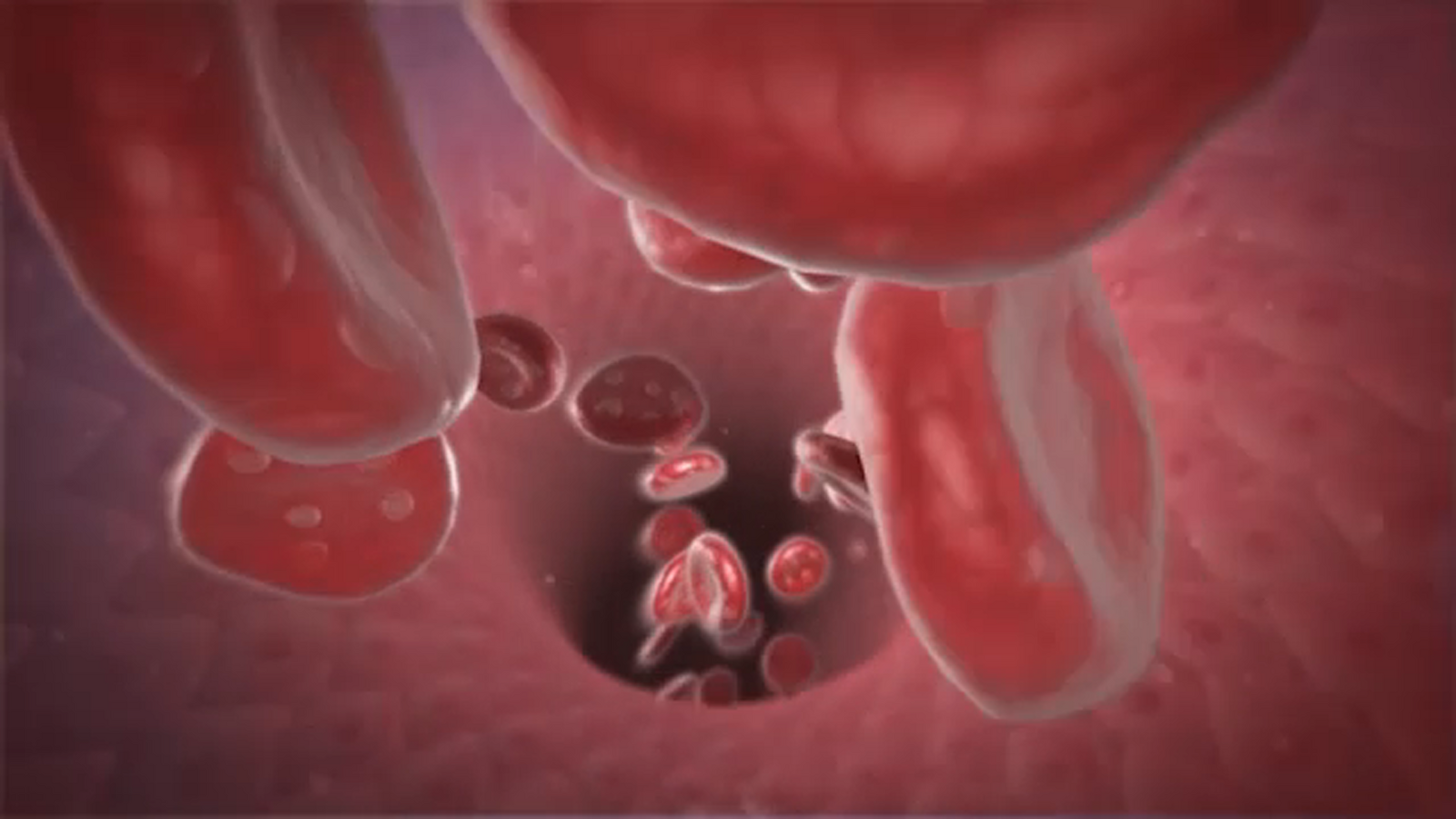 Sickle cell cure: FDA advisory committee approves 2 gene editing treatment therapies, including CRISPR - Vimarsana News