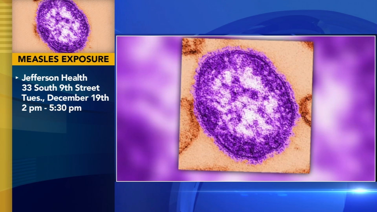Philadelphia health officials notify residents of possible measles exposure