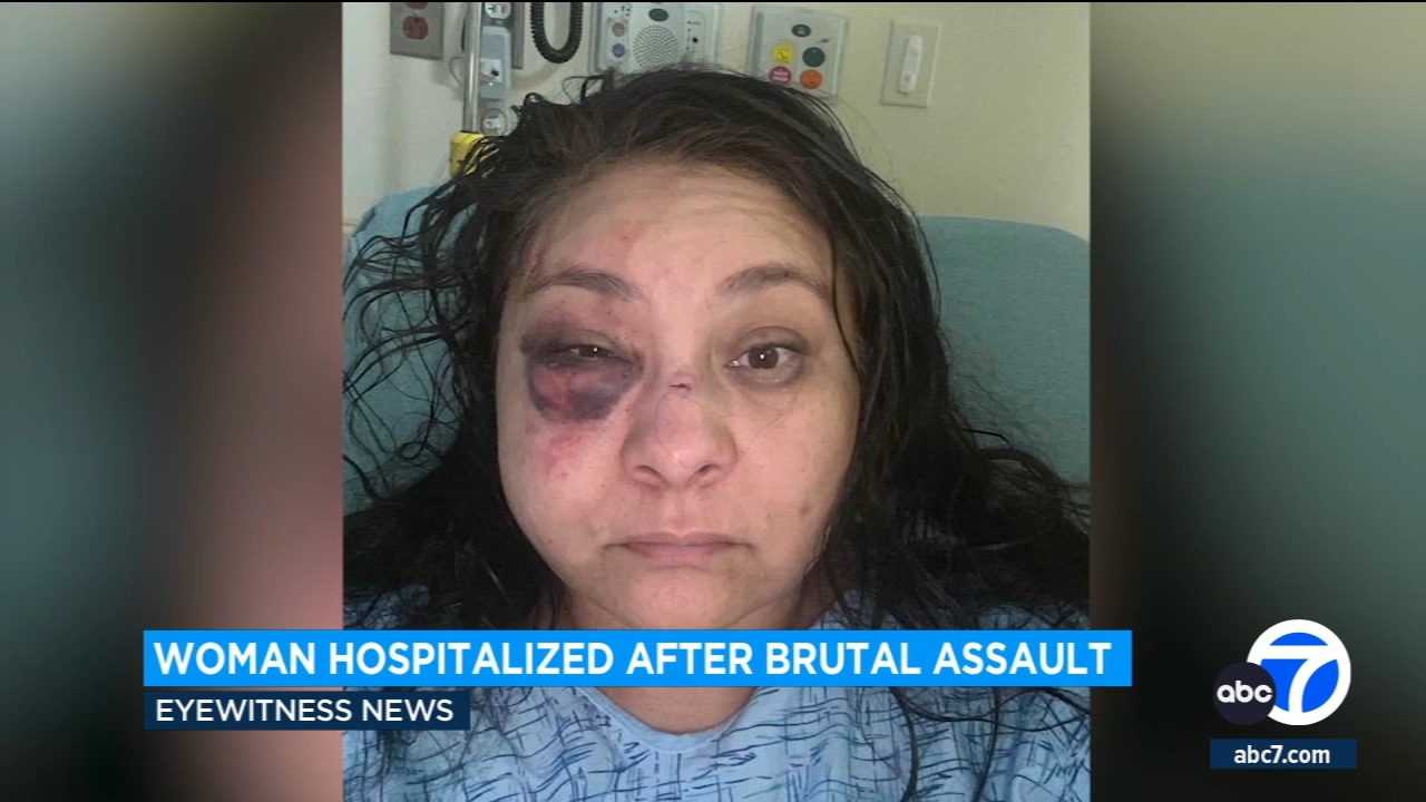 Man brutally attacks woman in Long Beach on her way to work
