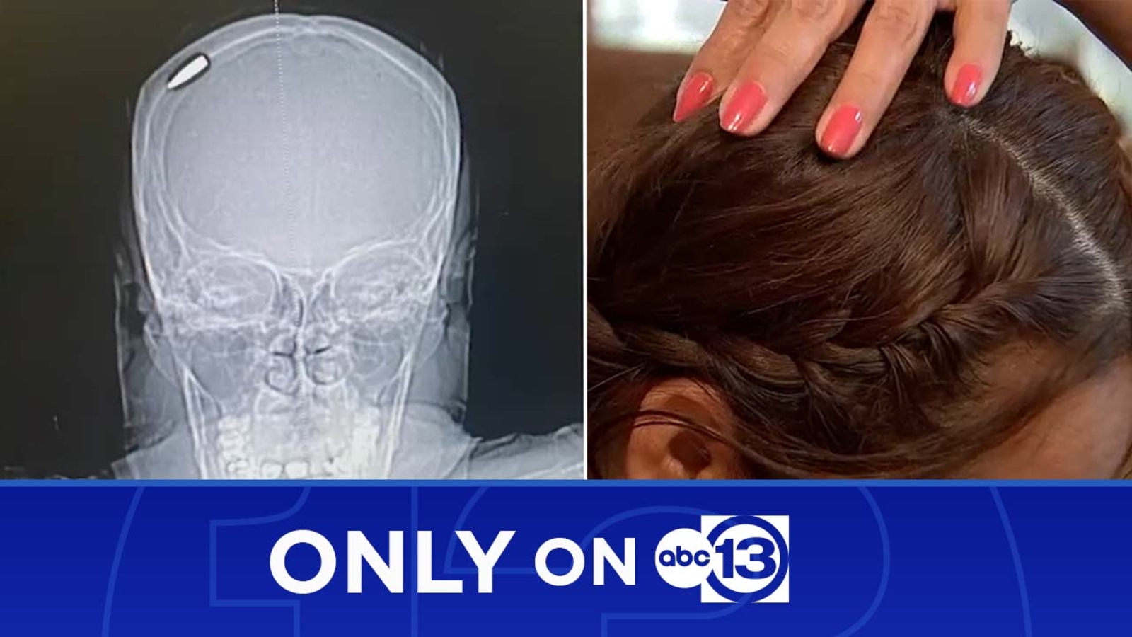 New Year's Eve celebratory gunfire: Woman says she was shot in the head ...