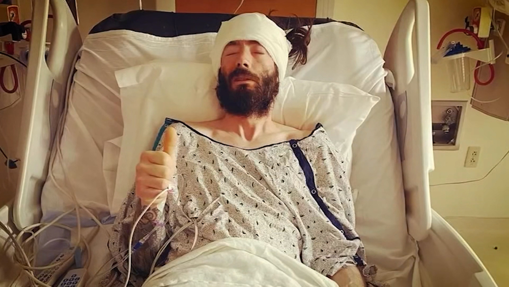 After finding a mass behind his eye a skate shop owner learns to ride again