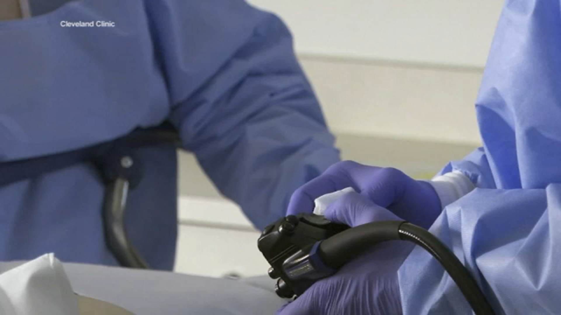 Younger adults being diagnosed with colon cancer, doctors say