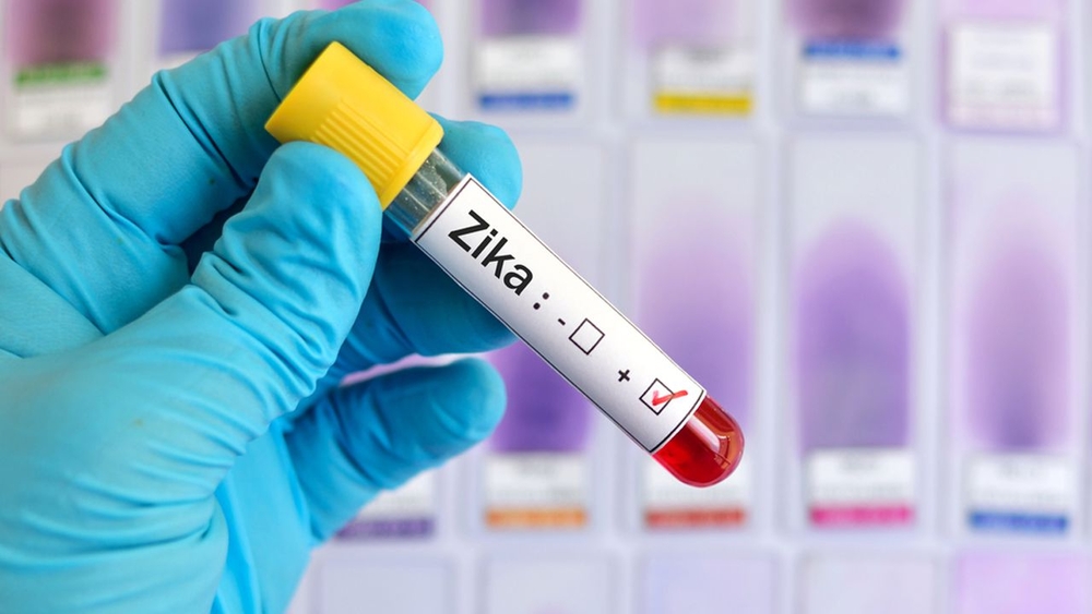 More than 2 dozen babies born in NYC with Zika-like birth defects