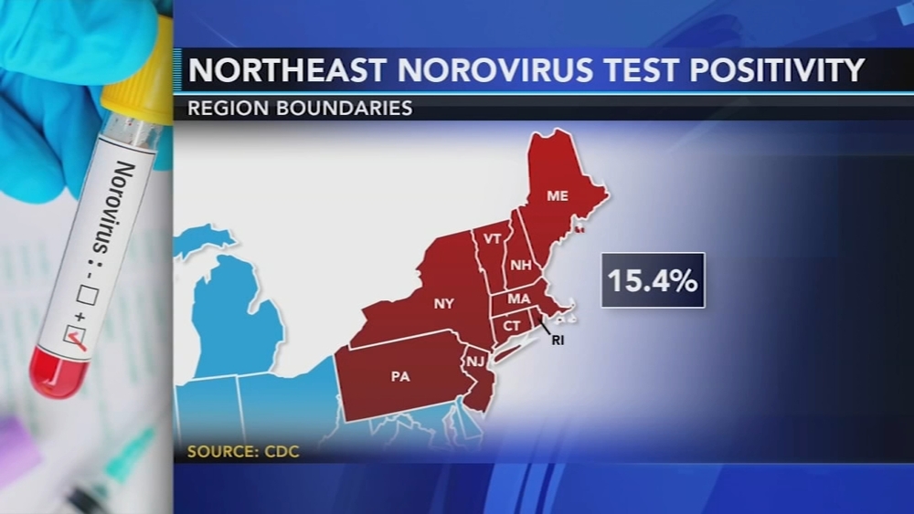 Contagious stomach bug circulating in the Northeast 