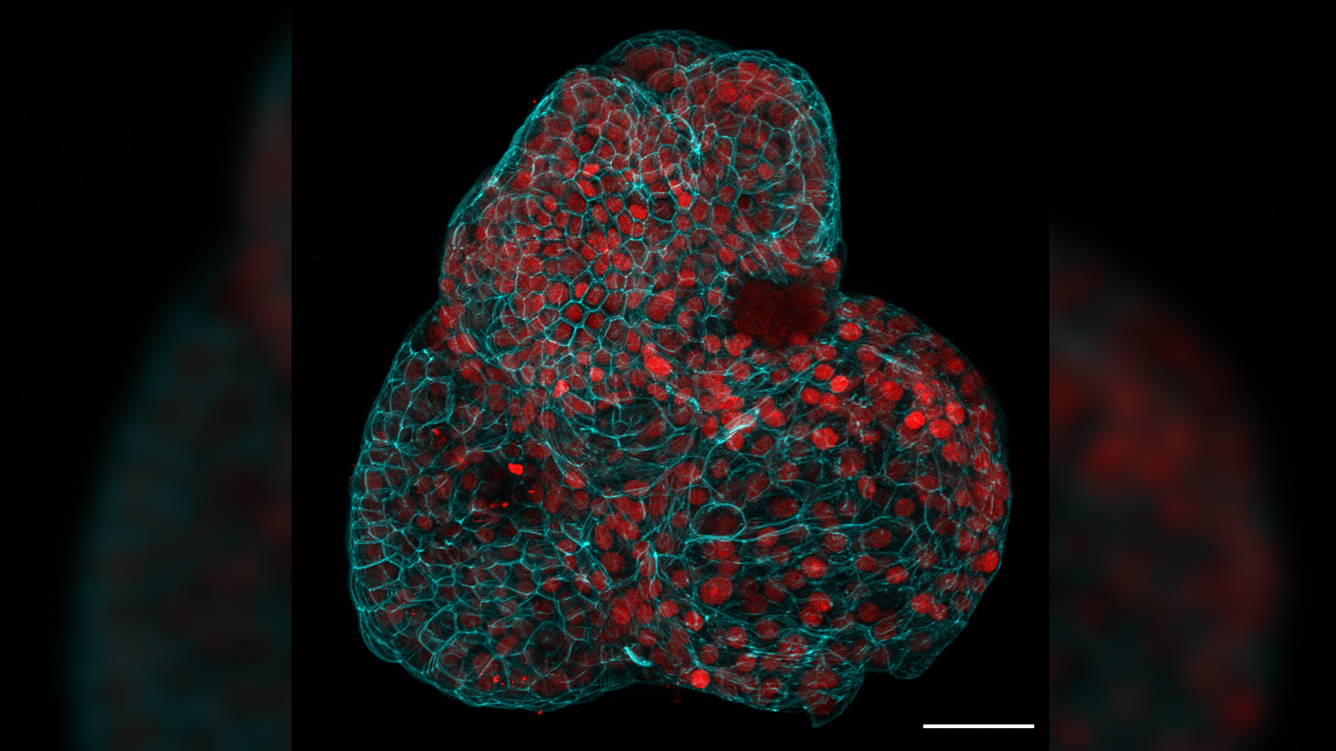 Cient&iacute;ficos utilizan c&eacute;lulas de l&iacute;quido amni&oacute;tico para cultivar  minipulmones y otros &oacute;rganos - ABC7 Los Angeles